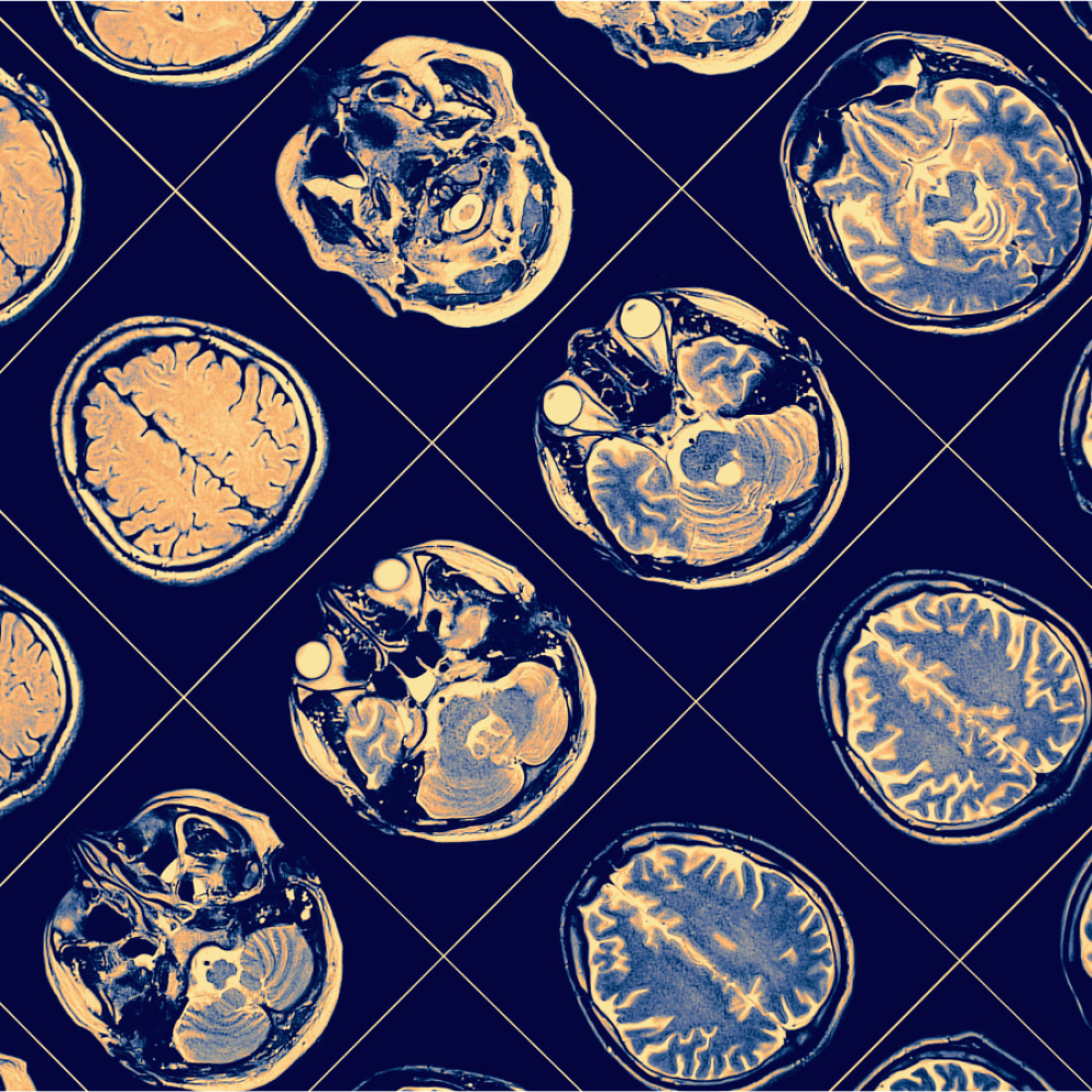 A Image of a brain scam